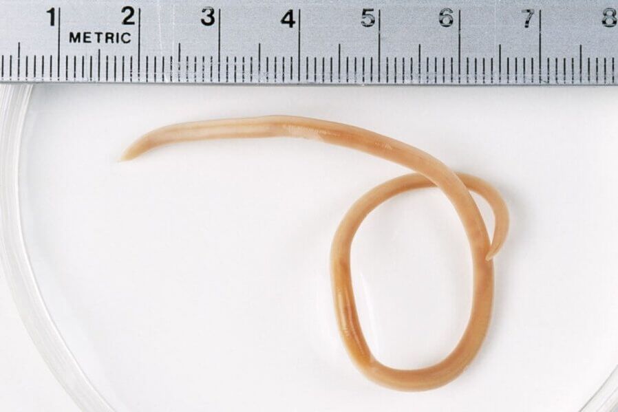 Ascaris is a roundworm that lives in the human body