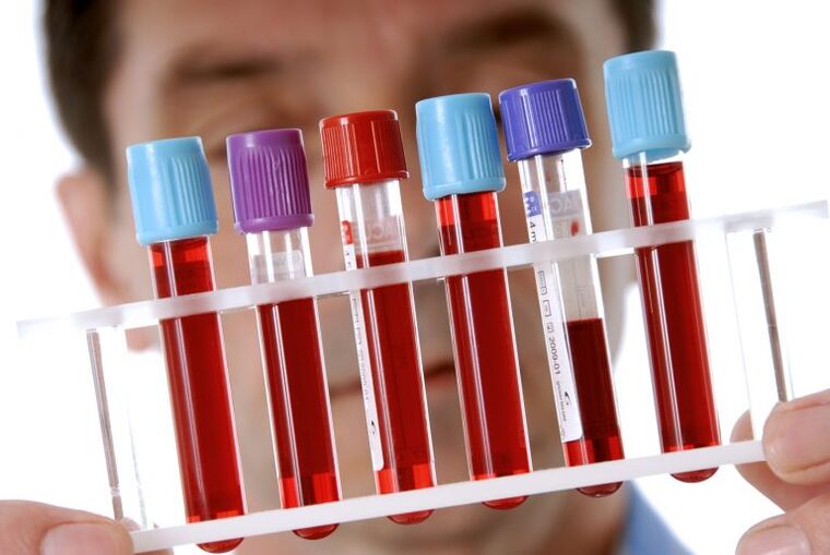 Blood test to diagnose helminthiasis